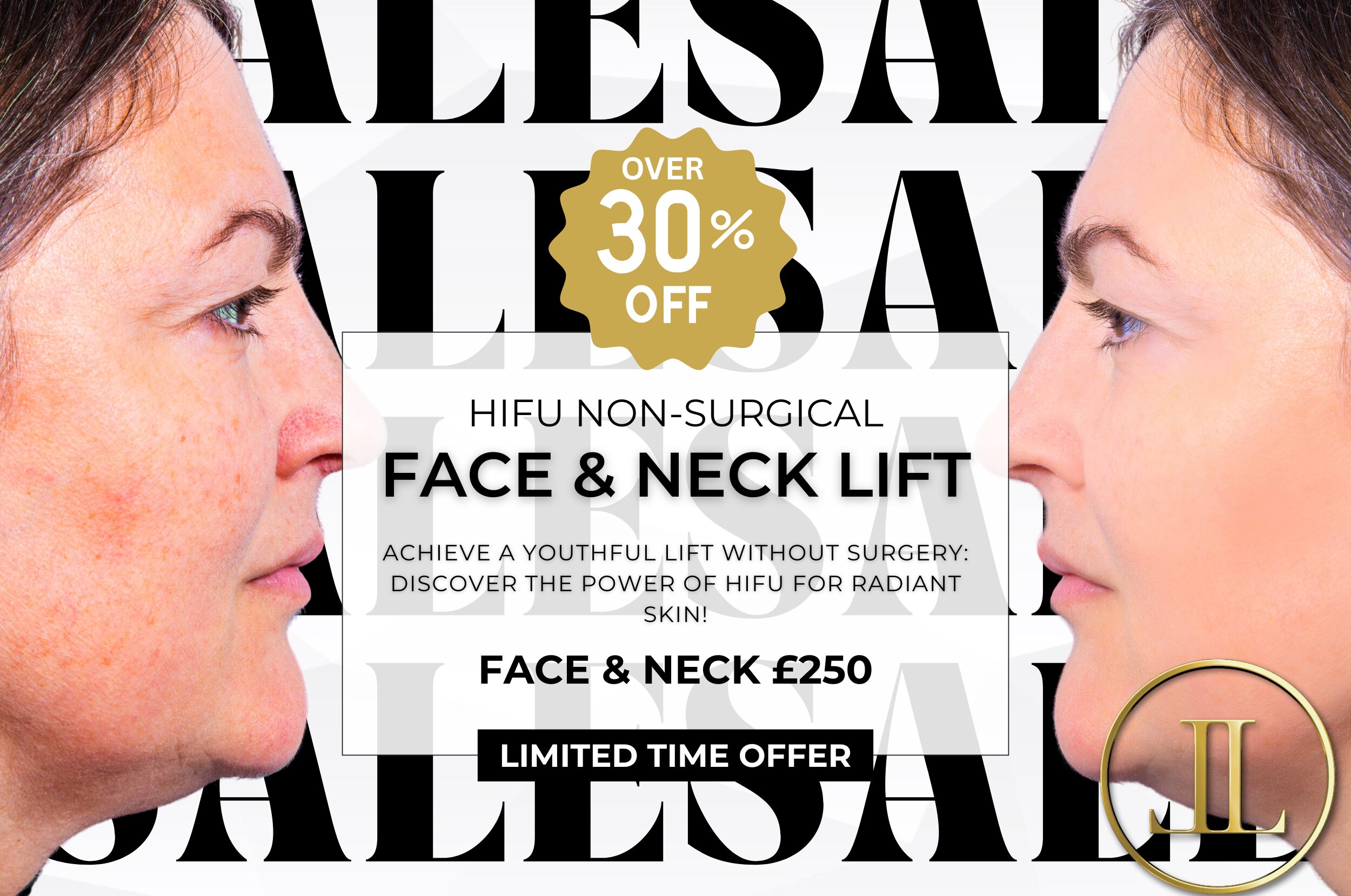 Before and after HIFU Face & Neck Lift